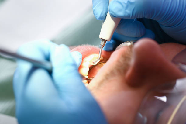 Best After-Hours Emergency Dentist in Trenton, GA