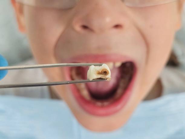 Best After-Hours Emergency Dentist in Trenton, GA